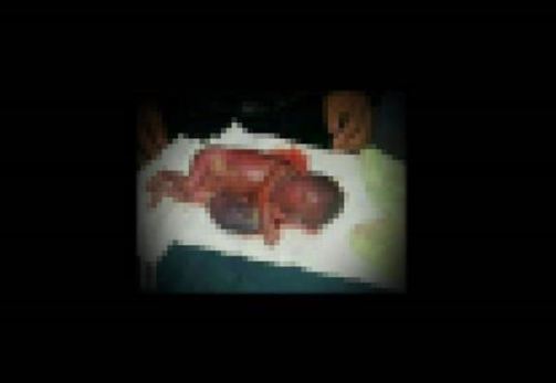 Seven month foetus aborted from a woman in China